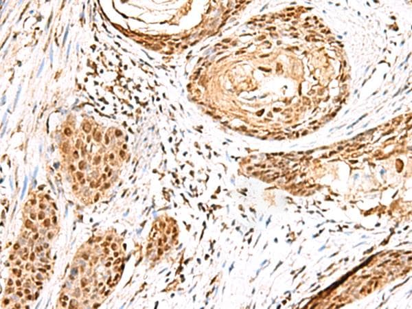 ELF3 / ESE1 Antibody