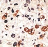 Polyclonal Rabbit anti-Human GJB3 / CX31 / Connexin 31 Antibody (aa227-257, IHC, WB)