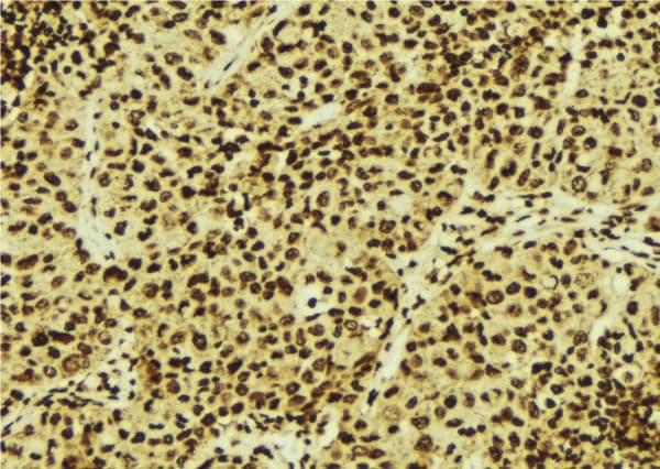 CARF / ALS2CR8 Antibody
