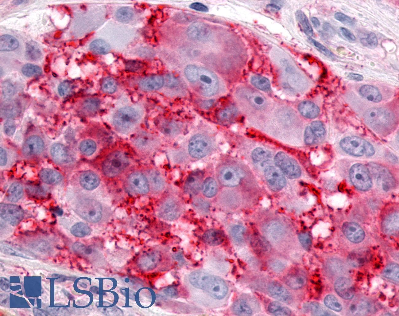 PathPlus™ Polyclonal Rabbit anti-Human ESRRG / ERR Gamma Antibody (C-Terminus, IHC, WB)