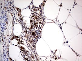 Monoclonal Mouse anti-Human PIK3CA / PI3K Alpha Antibody (clone OTI8D6, aa303-631, IHC)