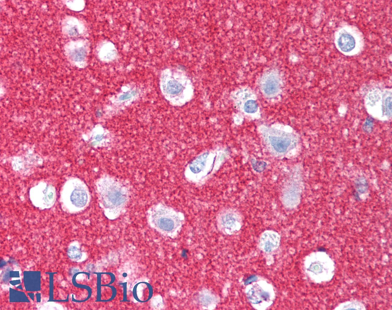 IHC-plus™ NCAM / CD56 Antibody (clone HCD56)