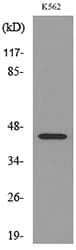 IL5RA / CD125 Antibody