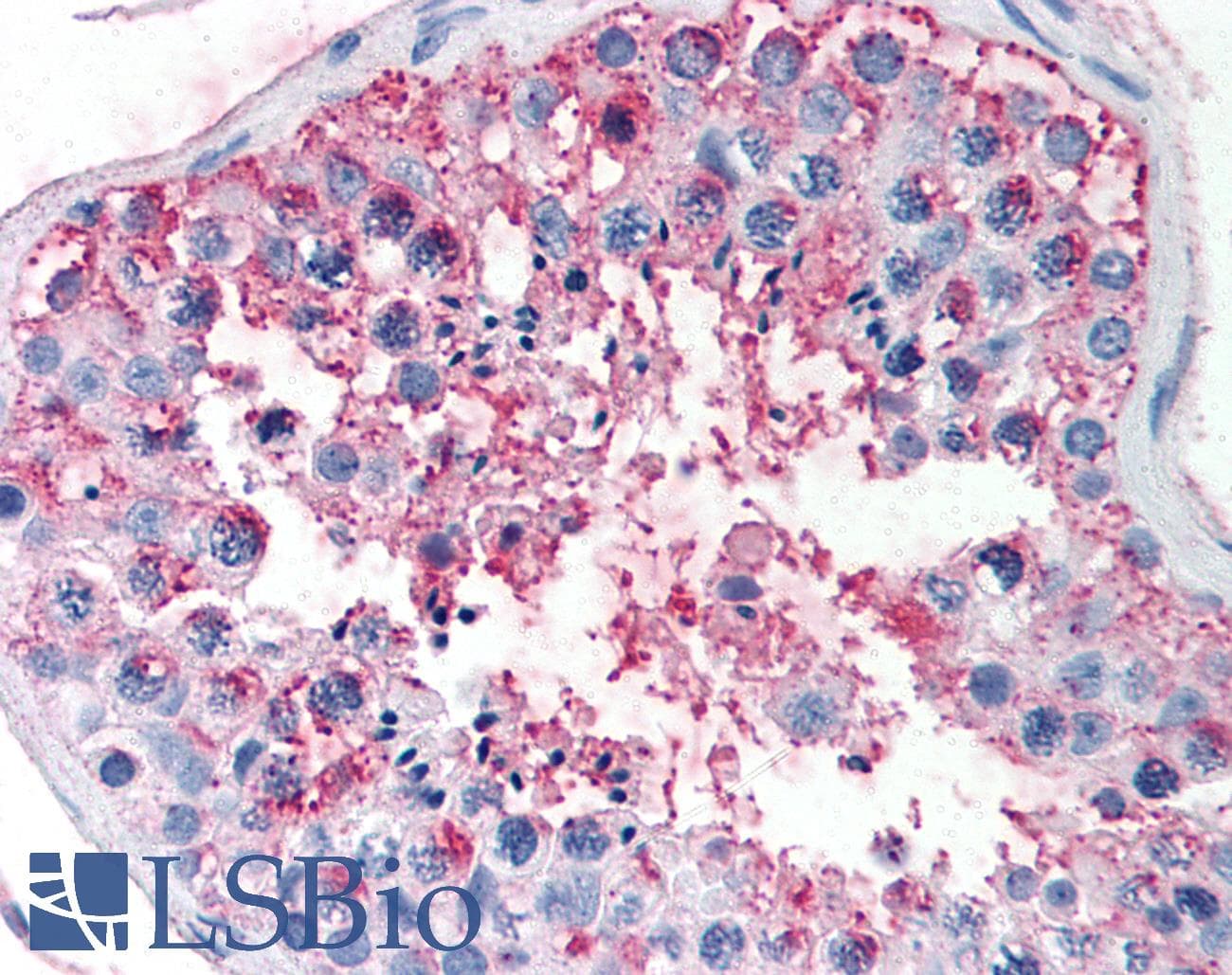 IHC-plus™ FSH Receptor / FSHR Antibody (N-Terminus)