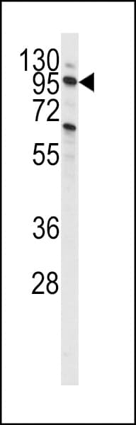 Polyclonal Rabbit anti-Human PIK3C3 / VPS34 Antibody (Ser851, IHC, WB)