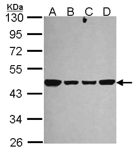 IHC-plus™ NDUFS2 Antibody (aa200-430)
