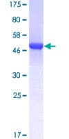 Human AK1 / Adenylate Kinase 1 Protein (Recombinant GST)