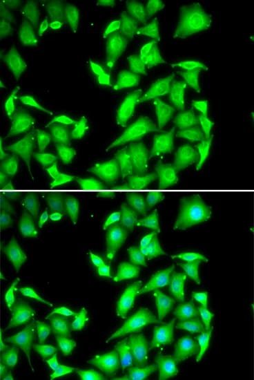 PPM1A / PP2CA Antibody