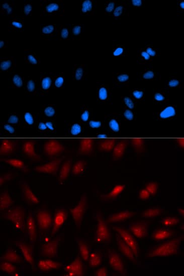PA2G4 / EBP1 Antibody