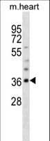 OLIG1 Antibody (aa200-228)