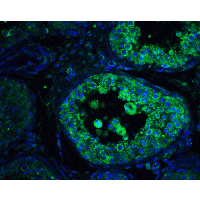 IHC-plus™ GOPC / PIST Antibody