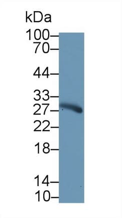 CELA3A / ELA3 Antibody (aa16-270)
