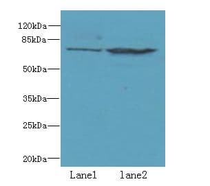 WDTC1 Antibody