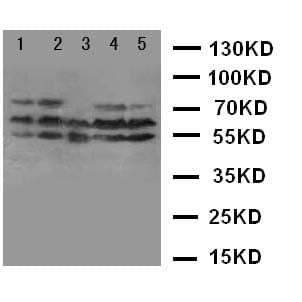 Polyclonal Rabbit anti-Human TACR1 / NK1R Antibody (aa231-245, WB)