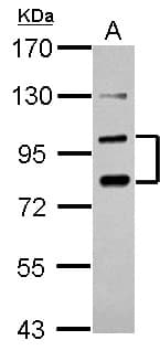 Polyclonal Rabbit anti-Human PCDHA6 Antibody (WB)