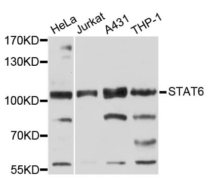 STAT6 Antibody