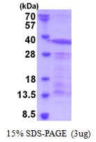 Human SPN / CD43 Protein (Recombinant His)