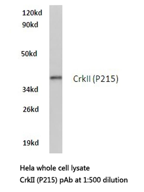 CRK Antibody (aa200-250)
