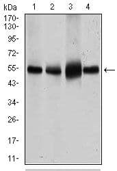 SLC2A4 / GLUT-4 Antibody (Amino Acid: 224-353, clone 3G10A3)