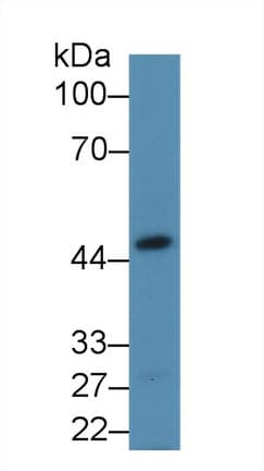 ALDOA / Aldolase A Antibody (aa18-273)