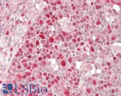 IHC-plus™ KPNA2 / Importin Alpha 1 Antibody