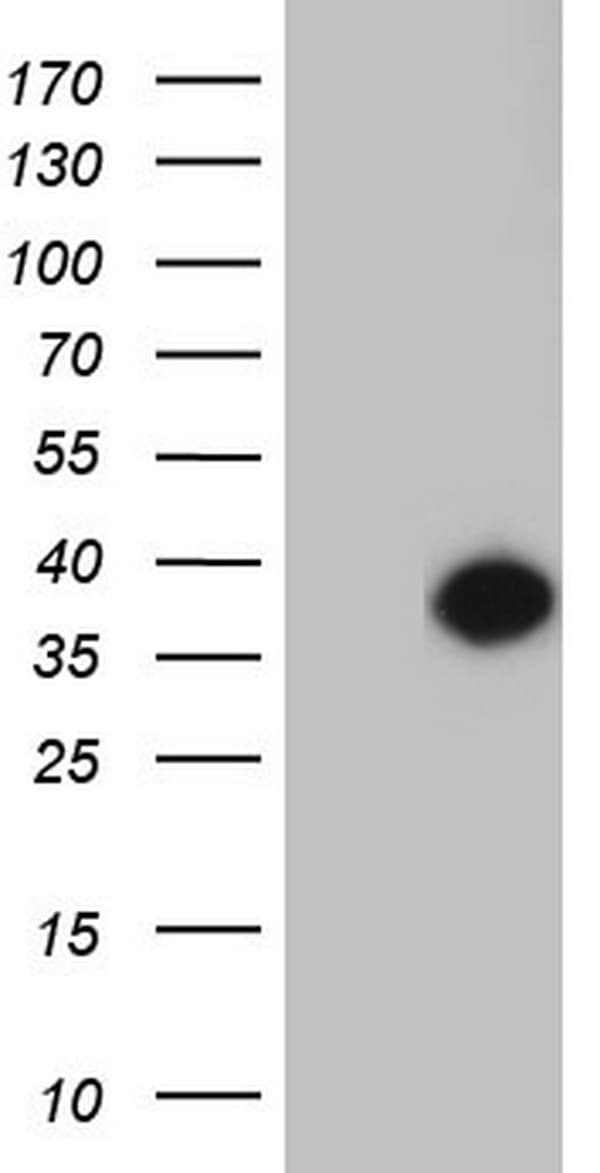 ENKUR Antibody (clone OTI5B4)