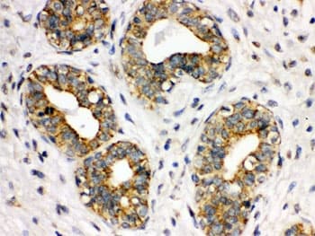 Polyclonal Rabbit anti-Human ITGA2B / CD41 Antibody (IHC, WB)
