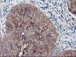 RPN1 / Ribophorin I Antibody (clone OTI2E3)