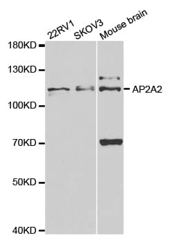 AP2A2 Antibody