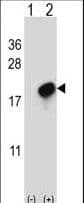 Polyclonal Rabbit anti-Human CMTM7 / CKLFSF7 Antibody (aa13-42, WB)