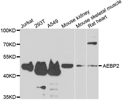AEBP2 Antibody