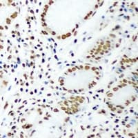 Polyclonal Rabbit anti-Human DR1 / NC2 Antibody (IHC, WB)