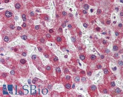 IHC-plus™ Polyclonal Rabbit anti-Human Prohibitin 2 / PHB2 Antibody (Tyr128, IHC, WB)