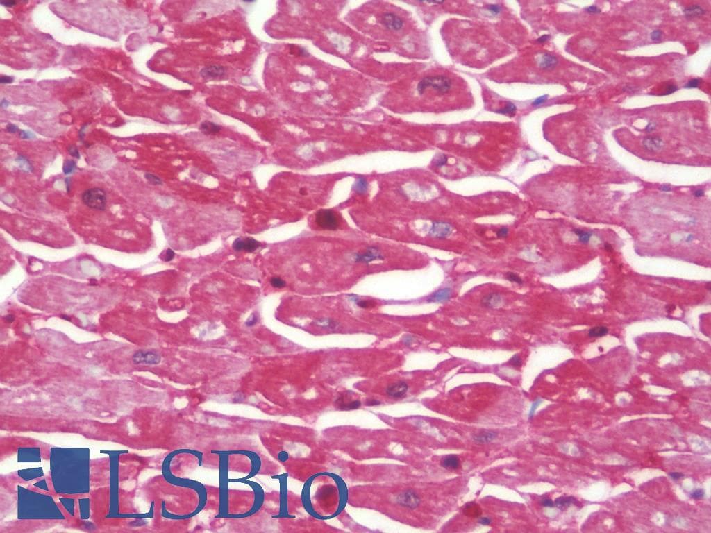 IHC-plus™ MRPL4 / MRP-L4 Antibody (aa90-139)