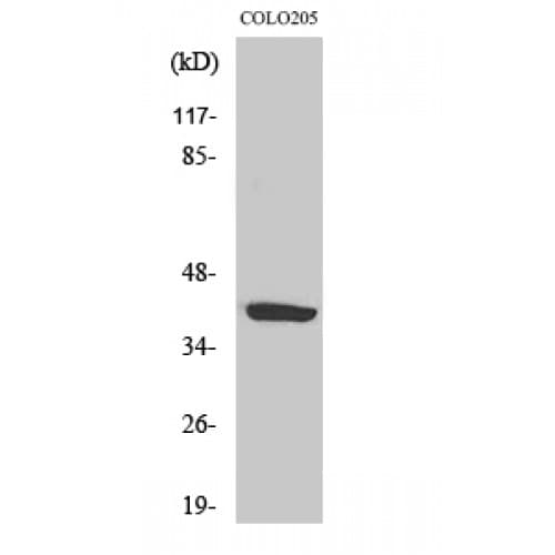 P2RY14 / GPR105 Antibody (120-200 aa, Internal)