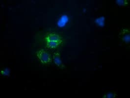 Monoclonal Mouse anti-Human CALCOCO2 Antibody (clone OTI2C11, IF, WB)