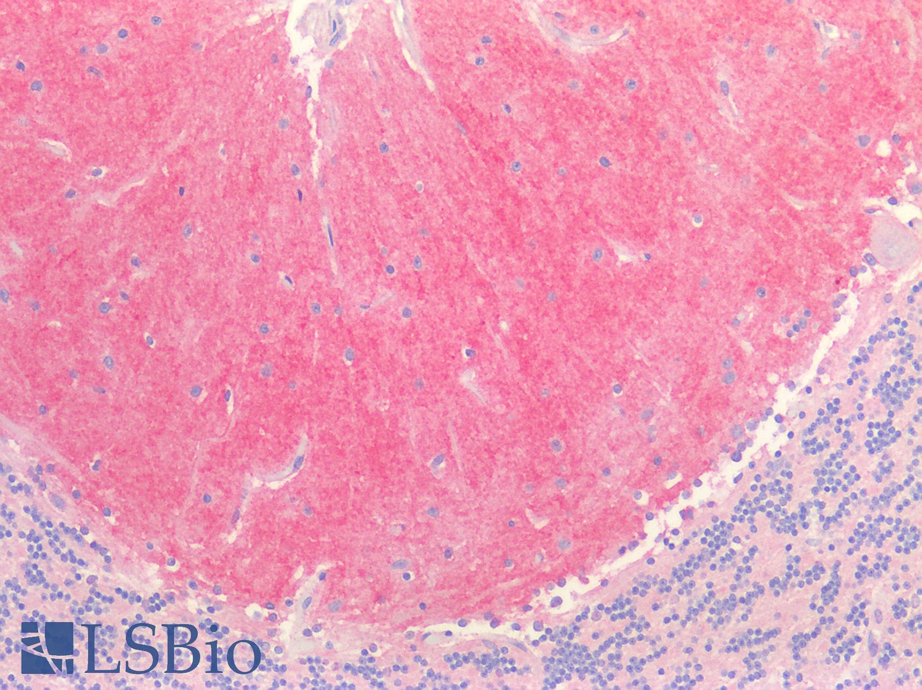 PathPlus™ Polyclonal Rabbit anti-Human IGSF4C / CADM4 Antibody (C-Terminus, IHC, WB)