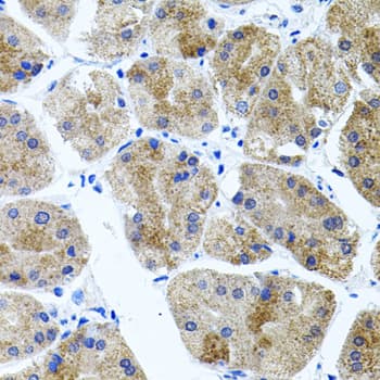 CDH23 / Cadherin 23 Antibody