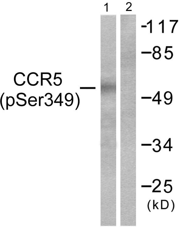 Polyclonal Rabbit anti-Human CCR5 Antibody (phospho-Ser349, WB)