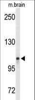 IHC-plus™ LONP2 / LONP Antibody (aa104-132)