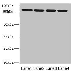 ITGB8 / Integrin Beta 8 Antibody