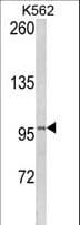 LPIN2 / Lipin 2 Antibody (aa262-288)