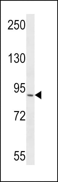 Polyclonal Rabbit anti-Human RRP1B Antibody (aa571-598, WB)
