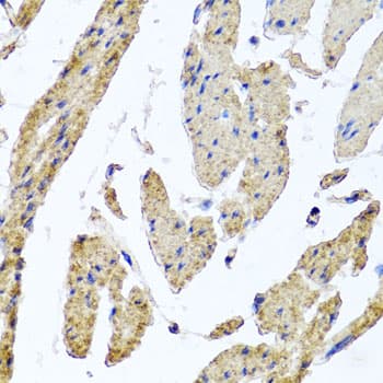 MRPL12 Antibody