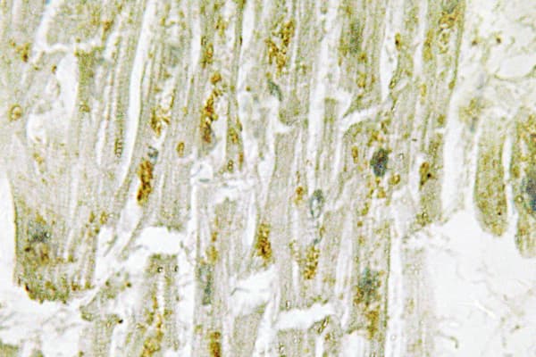 MAPK14 / p38 Antibody (Thr175)