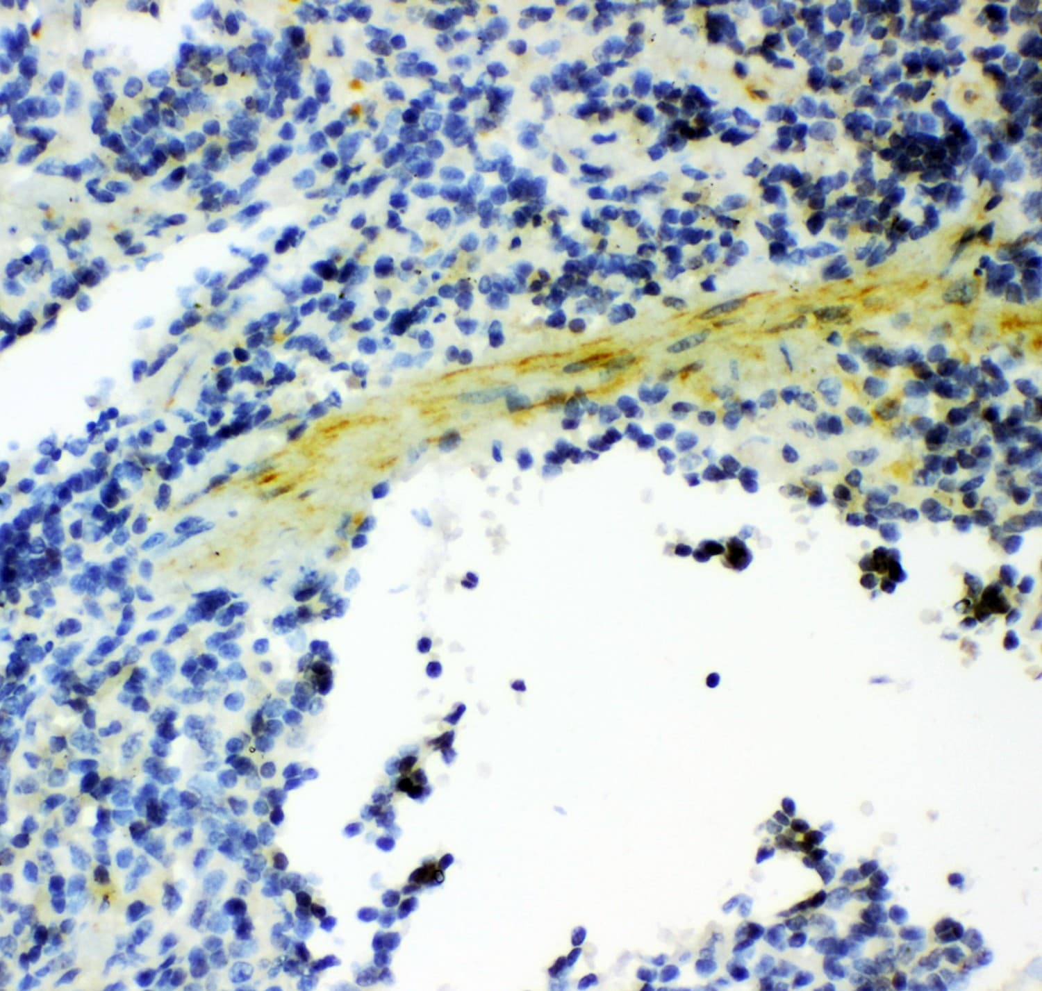Polyclonal Rabbit anti-Human GSN / Gelsolin Antibody (aa580-782, IHC, WB)