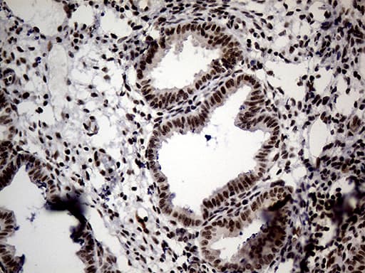 Monoclonal Mouse anti-Human SMC1A / SMC1 Antibody (clone OTI2D12, aa889-1016, IHC, WB)