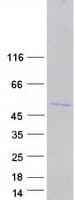 Human HNRNPD / AUF1 Protein (Recombinant Myc-DDK (Flag))