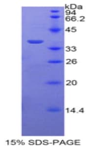 Human PPL / Periplakin Protein (Recombinant His-T7)