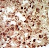 MAPK11 / SAPK2 / p38 Beta Antibody (aa334-366)